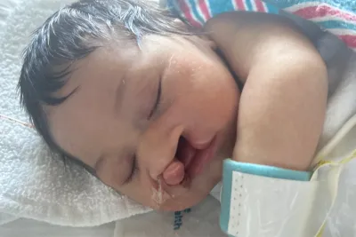 Before photo of Amara