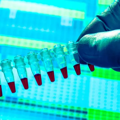 Gloved hand holding genetic sample