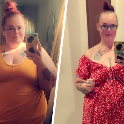 Charlene Bobo before and after bariatric surgery photos.