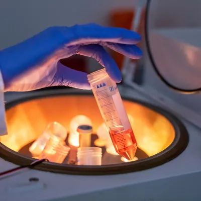 A Lab Sample is Bring Loaded into a Centrifuge 