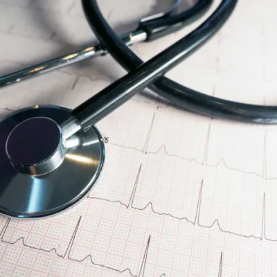 thransthoracic-echocardiogram