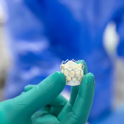 Transcatheter-Aortic-Valve-Replacement