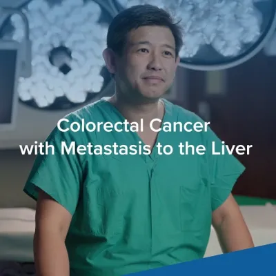 Dr. Iswanto Sucandy Colorectal Cancer with Metastasis