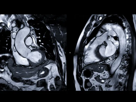 cardiac-mri-image-option1