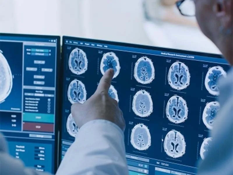 Reviewing brain scans