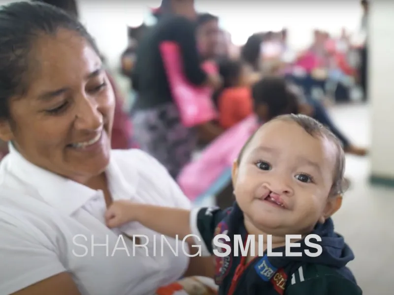 a woman holds a baby with a cleft lip