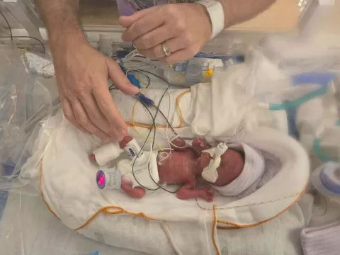 Baby Charlotte Peele, weighing less than a pound, sleeps in an incubator in the NICU. Unable to hold her, her father reaches in his hands to gently touch her.