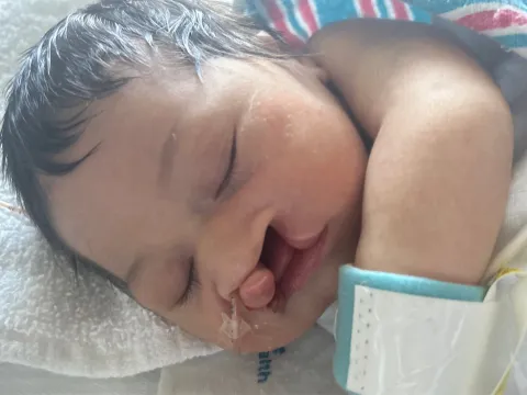 Before photo of Amara