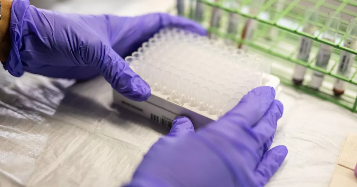 AdventHealth scientists help develop blood test that detects indicator