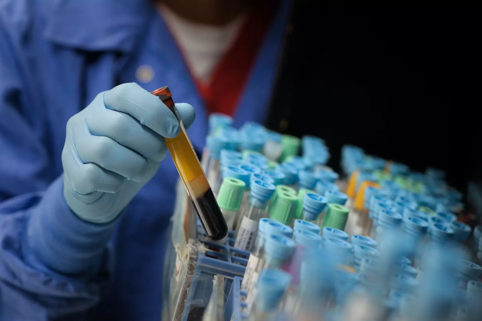 AdventHealth Scientists Help Develop Blood Test that Detects Indicator