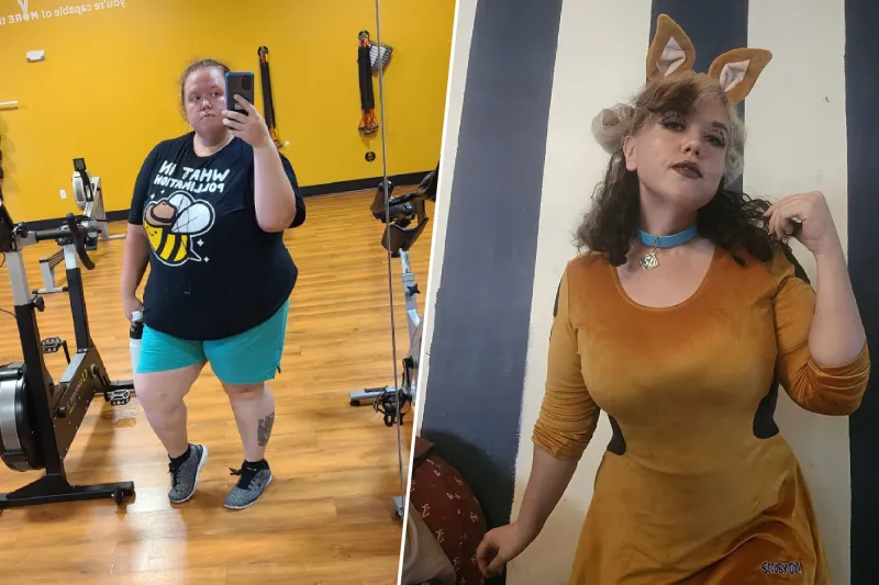 Meagan Before and After surgery