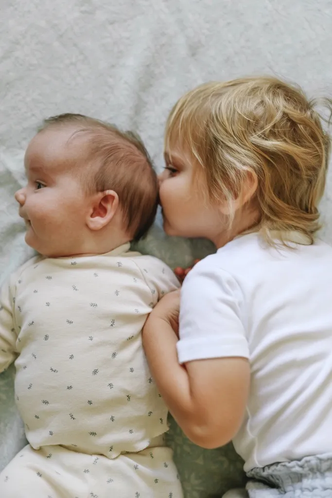 Patient picture before craniosynostosis treatment 