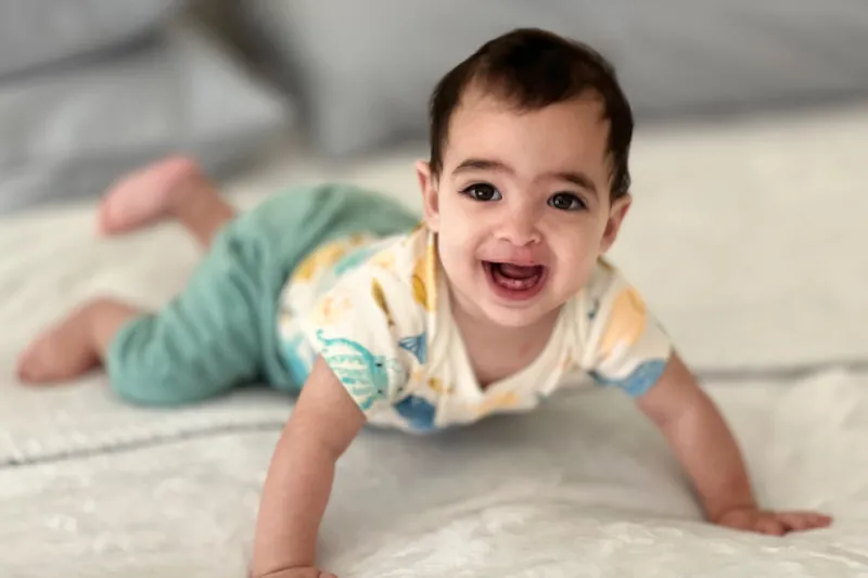 Piero after cleft surgery