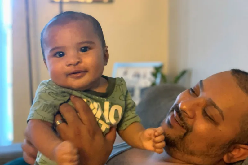 Romeo after cleft lip surgery