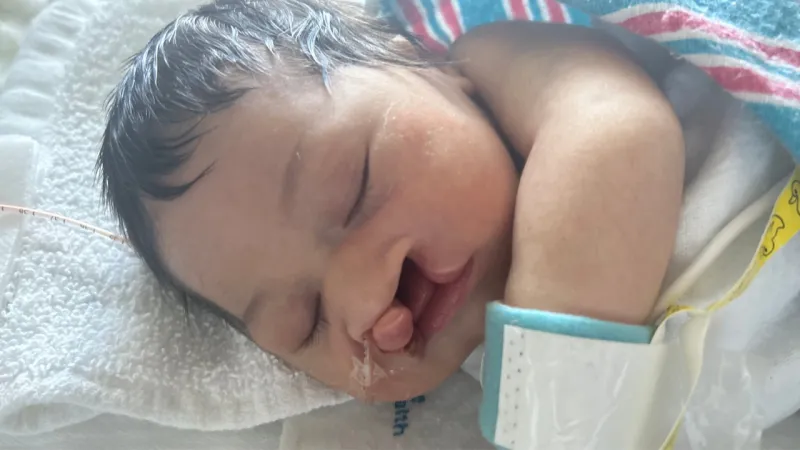 Before photo of Amara