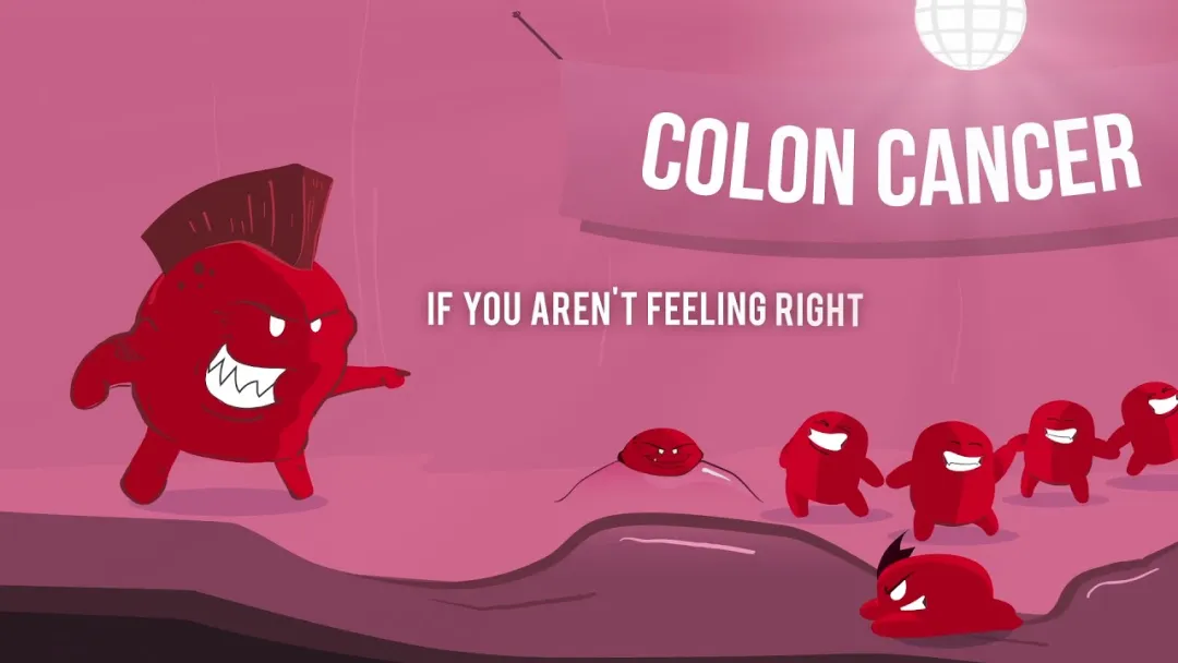 Trust Your Gut: Colon Cancer